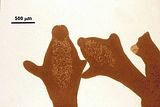 11 – Porzione apicale di un asse eretto con sori di tetrasporocisti